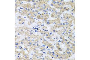 Immunohistochemistry of paraffin-embedded human liver injury using PEX3 antibody at dilution of 1:100 (x40 lens). (PEX3 anticorps)