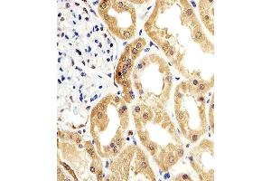 Immunohistochemical analysis of paraffin-embedded H. (ENO1 anticorps)