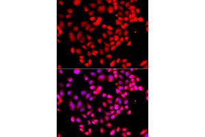 Immunofluorescence analysis of A549 cells using RPS6KL1 antibody (ABIN5975299). (RPS6KL1 anticorps)