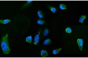 IF analysis of MSN using anti-MSN antibody (ABIN7600378). (Moesin anticorps  (AA 184-568))