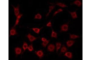 ABIN6275211 staining Hela by IF/ICC. (LDLRAD1 anticorps  (Internal Region))