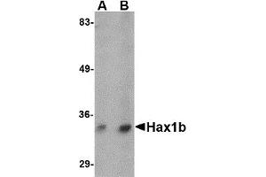 Western Blotting (WB) image for anti-Hax1b (N-Term) antibody (ABIN1031401) (Hax1b (N-Term) anticorps)
