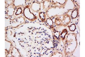 Paraformaldehyde-fixed, paraffin embedded human kidney, Antigen retrieval by boiling in sodium citrate buffer (pH6) for 15min, Block endogenous peroxidase by 3% hydrogen peroxide for 30 minutes, Blocking buffer (normal goat serum) at 37°C for 20min, Antibody incubation with Rabbit Anti-HSP27 (Ser15) Polyclonal Antibody, Unconjugated  at 1:500 overnight at 4°C, followed by a conjugated secondary for 90 minutes and DAB staining.
