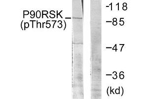 Western Blotting (WB) image for anti-Ribosomal Protein S6 Kinase, 90kDa, Polypeptide 3 (RPS6KA3) (pThr573) antibody (ABIN1847291) (RPS6KA3 anticorps  (pThr573))