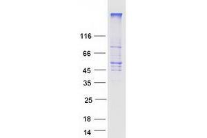 Validation with Western Blot