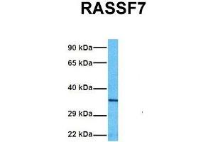 Host:  Rabbit  Target Name:  RASSF7  Sample Tissue:  Human A549  Antibody Dilution:  1.