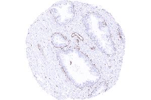 Prostate showing a distinct cytoplasmic MX1 staining of basal cells and of endothelial cells while acinar epithelial cells are negative