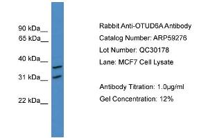 WB Suggested Anti-OTUD6A  Antibody Titration: 0. (OTUD6A anticorps  (N-Term))