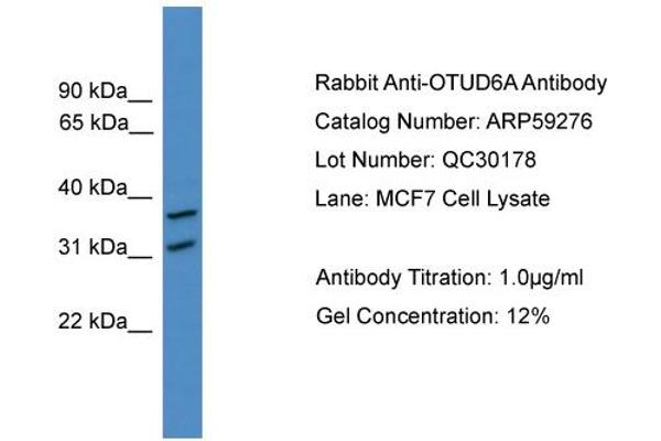 OTUD6A anticorps  (N-Term)