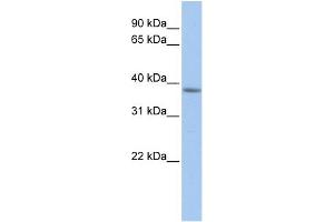 WB Suggested Anti-C2orf33 Antibody Titration:  0. (MFF anticorps  (C-Term))