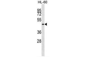 KRT28 Antibody (C-term) western blot analysis in HL-60 cell line lysates (35µg/lane). (Cytokeratin 28 anticorps  (C-Term))