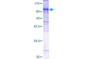 Image no. 1 for Solute Carrier Family 4, Sodium Bicarbonate Cotransporter, Member 4 (SLC4A4) (AA 1-646) protein (GST tag) (ABIN1320476)
