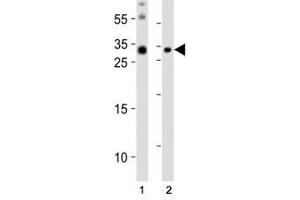 Western blot analysis of lysate from (1) mouse brain and (2) mouse skeletal muscle tissue lysate using Olig3 antibody at 1:1000.