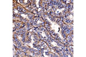 IHC analysis of NEAS/SPTAN1 using anti-NEAS/SPTAN1 antibody (ABIN7600436). (SPTAN1 anticorps  (AA 1916-2472))