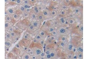 Detection of PIK3Cb in Human Liver Tissue using Polyclonal Antibody to Phosphoinositide-3-Kinase Catalytic Beta Polypeptide (PIK3Cb)