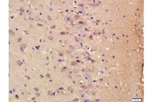 Formalin-fixed and paraffin embedded rat brain labeled with Rabbit Anti-S100B Polyclonal Antibody, Unconjugated  at 1:200 followed by conjugation to the secondary antibody and DAB staining