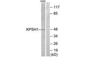 Western blot analysis of extracts from A549 cells, using KPSH1 Antibody. (PSKH1 anticorps  (AA 261-310))