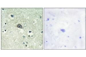 Immunohistochemical analysis of paraffin-embedded human brain tissue using NMDAR1 (Phospho-Ser890) antibody (left)or the same antibody preincubated with blocking peptide (right). (GRIN1/NMDAR1 anticorps  (pSer890))