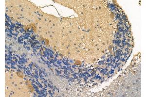 ABIN6264011 and ABIN6278159 at 1/100 staining Rat brain tissue by IHC-P.