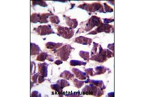 anti-Leucine-Rich Repeats and Immunoglobulin-Like Domains 2 (LRIG2) (AA 817-845), (C-Term) antibody