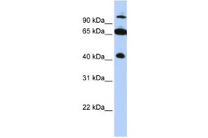 Western Blotting (WB) image for anti-Tripartite Motif Containing 9 (TRIM9) antibody (ABIN2458078) (TRIM9 anticorps)