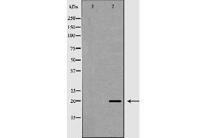 Western blot analysis of Hepg2 whole cell lysates, using TAF9 Antibody.