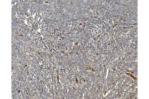 IHC analysis of EIF3C using anti-EIF3C antibody (ABIN7602528). (EIF3C anticorps  (AA 81-637))