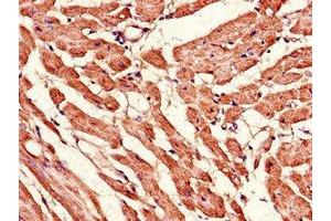 Immunohistochemistry of paraffin-embedded human heart tissue using ABIN7159968 at dilution of 1:100