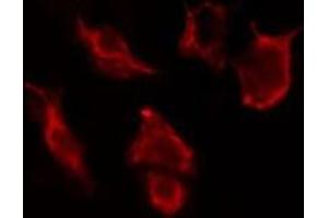 ABIN6277108 staining HuvEc cells by IF/ICC. (CD90 anticorps  (Internal Region))