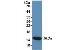 Detection of Recombinant CST3, Human using Monoclonal Antibody to Cystatin C (Cys-C) (Cystathionine-gamma-Synthase Precursor (CYS) (AA 27-146) anticorps)