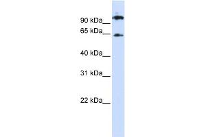 WB Suggested Anti-RUNX1T1 Antibody Titration: 0. (RUNX1T1 anticorps  (Middle Region))
