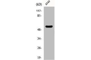 Western Blot analysis of Jurkat cells using CHST2 Polyclonal Antibody (CHST2 anticorps  (N-Term))