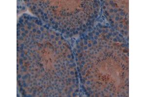 Used in DAB staining on fromalin fixed paraffin- embedded Kidney tissue