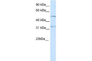 WB Suggested Anti-KCNAB2 Antibody Titration:  0.