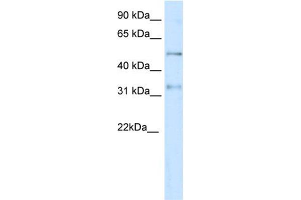 KCNAB2 anticorps  (Middle Region)