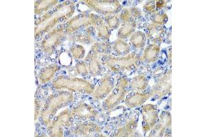 Immunohistochemistry of paraffin-embedded rat kidney using PDCD6 antibody.