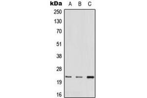Western blot analysis of MED22 expression in A549 (A), mouse heart (B), rat liver (C) whole cell lysates.