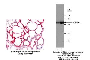 Image no. 3 for anti-CD36 (CD36) (AA 100-200) antibody (ABIN363469) (CD36 anticorps  (AA 100-200))