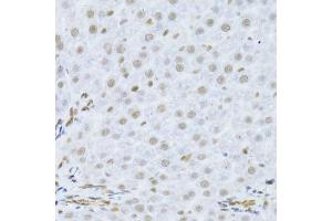 Immunohistochemistry of paraffin-embedded human liver using MAPK3 Antibody.