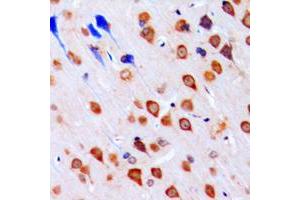 Immunohistochemical analysis of CHK1 staining in human brain formalin fixed paraffin embedded tissue section.