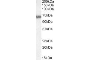 Image no. 1 for anti-ATP-Binding Cassette, Sub-Family D (Ald), Member 4 (ABCD4) (Internal Region) antibody (ABIN375164) (ABCD4 anticorps  (Internal Region))