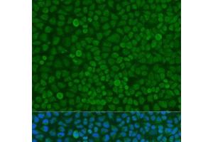 Immunofluorescence analysis of U2OS cells using YWHAZ Polyclonal Antibody at dilution of 1:100. (14-3-3 zeta anticorps)