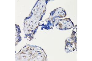 Immunohistochemistry of paraffin-embedded human placenta using ErbB4/HER4 Rabbit pAb (ABIN6131263, ABIN6140257, ABIN6140260 and ABIN6221732) at dilution of 1:100 (40x lens).