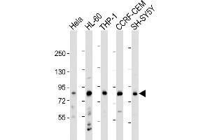 All lanes : Anti-LRCH4 Antibody (Center) at 1:2000 dilution Lane 1: Hela whole cell lysate Lane 2: HL-60 whole cell lysate Lane 3: THP-1 whole cell lysate Lane 4: CCRF-CEM whole cell lysate Lane 5: SH-SY5Y whole cell lysate Lysates/proteins at 20 μg per lane. (LRCH4 anticorps  (AA 305-348))
