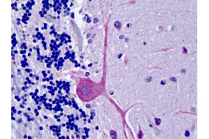 Anti-OSBPL1A / ORP1 antibody IHC of human brain, cerebellum.