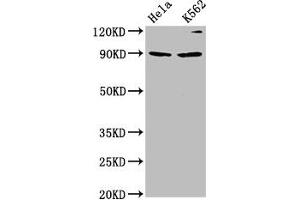 Western Blot Positive WB detected in: Hela whole cell lysate, K562 whole cell lysate All lanes: KIF3C antibody at 4. (KIF3C anticorps  (AA 158-267))