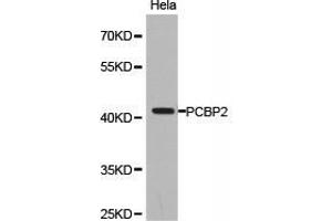 Western Blotting (WB) image for anti-Poly(rC) Binding Protein 2 (PCBP2) antibody (ABIN1874052)