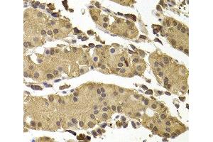 Immunohistochemistry of paraffin-embedded Human stomach using SETD5 Polyclonal Antibody at dilution of 1:100 (40x lens). (SETD5 anticorps)