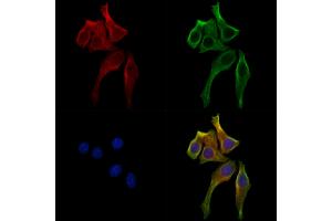ABIN7094237 and ABIN7098284 staining Hela cells by IF/ICC.