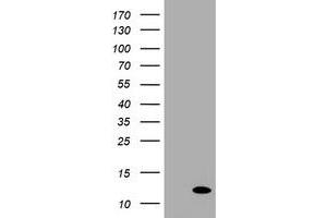Image no. 1 for anti-Chromosome 17 Open Reading Frame 37 (C17orf37) antibody (ABIN1501783) (C17orf37 anticorps)